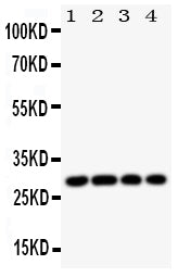 Anti-HLA DMB/HLA-DMB Antibody Picoband®
