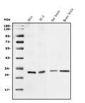 Anti-14-3-3 sigma/SFN Antibody Picoband®