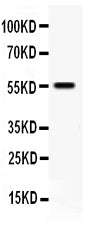 Anti-TFPI antibody, PA1798, Western blotting
All lanes: Anti TFPI (PA1798) at 0.5ug/ml
WB: SMMC Whole Cell Lysate at 40ug
Predicted bind size: 26KD
Observed bind size: 55KD