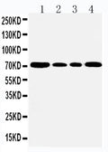 Anti-GRP78 BiP antibody, PA1815, Western blotting
Lane 1: Rat Testis Tissue Lysate
Lane 2: A549 Cell Lysate
Lane 3: MCF-7 Cell Lysate
Lane 4: HELA Cell Lysate