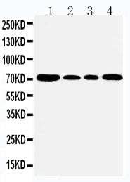 Anti-GRP78 BiP antibody, PA1815, Western blotting
Lane 1: Rat Testis Tissue Lysate
Lane 2: A549 Cell Lysate
Lane 3: MCF-7 Cell Lysate
Lane 4: HELA Cell Lysate