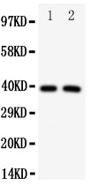 Anti-IRF2 antibody, PA1818, Western blotting
All lanes: Anti IRF2 (PA1818) at 0.5ug/ml

Lane 1: HELA Whole Cell Lysate at 40ug

Lane 2: MCF-7 Whole Cell Lysate at 40ug

Predicted bind size: 39KD

Observed bind size: 39KD
