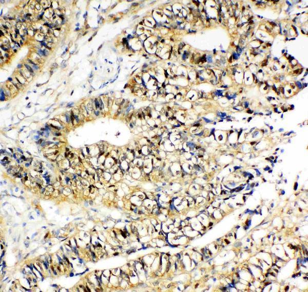 Anti-NME2 Antibody Picoband®