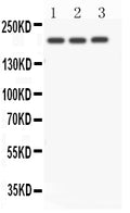 Anti-NOTCH4 antibody, PA1831, Western blotting
All lanes: Anti NOTCH4 (PA1831) at 0.5ug/ml
Lane 1: A549 Whole Cell Lysate at 40ug
Lane 2: SMMC Whole Cell Lysate at 40ug
Lane 3: HELA Whole Cell Lysate at 40ug
Predicted bind size: 210KD
Observed bind size: 210KD