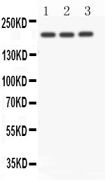 Anti-NOTCH4 antibody, PA1831, Western blotting
All lanes: Anti NOTCH4 (PA1831) at 0.5ug/ml
Lane 1: A549 Whole Cell Lysate at 40ug
Lane 2: SMMC Whole Cell Lysate at 40ug
Lane 3: HELA Whole Cell Lysate at 40ug
Predicted bind size: 210KD
Observed bind size: 210KD