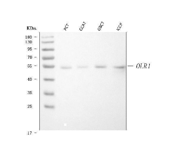 Anti-LOX 1/OLR1 Antibody Picoband®