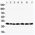 Anti-Peroxiredoxin 4 antibody, PA1837, Western blotting
Lane 1: Rat Brain Tissue Lysate
Lane 2: Rat Lung Tissue Lysate
Lane 3: Rat Liver Tissue Lysate 
Lane 4: Rat Kidney Tissue Lysate
Lane 5: HELA Cell Lysate 
Lane 6: 293T Cell Lysate
Lane 7: MCF-7 Cell Lysate