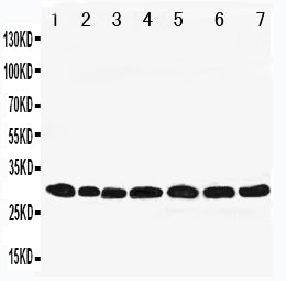 Anti-Peroxiredoxin 4 antibody, PA1837, Western blotting
Lane 1: Rat Brain Tissue Lysate
Lane 2: Rat Lung Tissue Lysate
Lane 3: Rat Liver Tissue Lysate 
Lane 4: Rat Kidney Tissue Lysate
Lane 5: HELA Cell Lysate 
Lane 6: 293T Cell Lysate
Lane 7: MCF-7 Cell Lysate