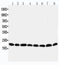 Anti-Peroxiredoxin 5 antibody, PA1838, Western blotting
Lane 1: Rat Brain Tissue Lysate
Lane 2: Rat Lung Tissue Lysate
Lane 3: Rat Liver Tissue Lysate
Lane 4: Rat Kidney Tissue Lysate
Lane 5: HELA Cell Lysate 
Lane 6: 293T Cell Lysate
Lane 7: MCF-7 Cell Lysate

Lane 8: A549 Cell Lysate