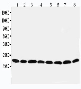 Anti-Peroxiredoxin 5 antibody, PA1838, Western blotting
Lane 1: Rat Brain Tissue Lysate
Lane 2: Rat Lung Tissue Lysate
Lane 3: Rat Liver Tissue Lysate
Lane 4: Rat Kidney Tissue Lysate
Lane 5: HELA Cell Lysate 
Lane 6: 293T Cell Lysate
Lane 7: MCF-7 Cell Lysate

Lane 8: A549 Cell Lysate