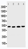 Anti-DR5 antibody, PA1842, Western blotting
Lane 1: HELA Cell Lysate
Lane 2: MM231 Cell Lysate
Lane 3: SGC Cell Lysate
Lane 4: HT1080 Cell Lysate