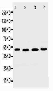 Anti-DR5 antibody, PA1842, Western blotting
Lane 1: HELA Cell Lysate
Lane 2: MM231 Cell Lysate
Lane 3: SGC Cell Lysate
Lane 4: HT1080 Cell Lysate