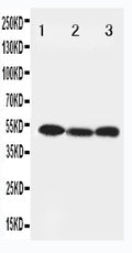 Anti-Beclin 1 antibody, PA1847, Western blotting
Lane 1: HELA Cell Lysate
Lane 2: SW620 Cell Lysate
Lane 3: PANC Cell Lysate