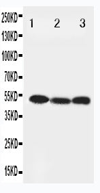 Anti-Beclin 1 antibody, PA1847, Western blotting
Lane 1: HELA Cell Lysate
Lane 2: SW620 Cell Lysate
Lane 3: PANC Cell Lysate