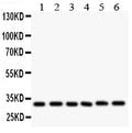 Anti-CASP3 antibody, PA1849, Western blotting
All lanes: Anti CASP3 (PA1849) at 0.5ug/ml
Lane 1: Rat Cardiac Muscle Tissue Lysate at 50ug
Lane 2: Rat Liver Tissue Lysate at 50ug
Lane 3: Rat Thymus Tissue Lysate at 50ug
Lane 4: MCF-7 Whole Cell Lysate at 40ug
Lane 5: SMMC Whole Cell Lysate at 40ug
Lane 6: HT1080 Whole Cell Lysate at 40ug
Predicted bind size: 31KD
Observed bind size: 31KD