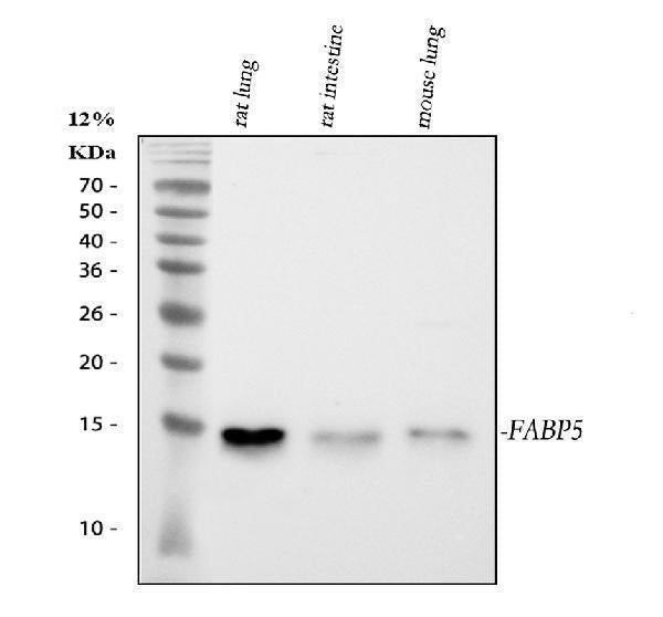 Anti-Fatty Acid Binding Protein 5/FABP5 Antibody Picoband®