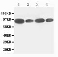 Anti-FES antibody, PA1854-1, All Western blotting
All lanes: Anti-FES(PA1854-1) at 0.5ug/ml

Lane 1: HELA Whole Cell Lysate at 40ug

Lane 2: 293T Whole Cell Lysate at 40ug

Lane 3: SKOV Whole Cell Lysate at 40ug

Lane 4: A549 Whole Cell Lysate at 40ug

Predicted bind size: 93KD

Observed bind size: 93KD