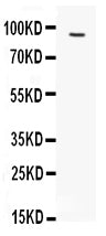 Anti-FES antibody, PA1854, Western blotting
All lanes: Anti FES (PA1854) at 0.5ug/ml
WB: HELA Whole Cell Lysate at 40ug
Predicted bind size: 93KD
Observed bind size: 93KD