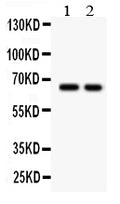 Anti-TGF beta Receptor II/TGFBR2 Antibody Picoband®