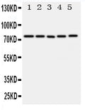 Anti-ABCG1 antibody, PA1868, Western blotting
All lanes: Anti ABCG1 (PA1868) at 0.5ug/ml

Lane 1: U87 Whole Cell Lysate at 40ug

Lane 2: SMMC Whole Cell Lysate at 40ug

Lane 3: HELA Whole Cell Lysate at 40ug

Lane 4: COLO320 Whole Cell Lysate at 40ug

Lane 5: MCF-7 Whole Cell Lysate at 40ug

Predicted bind size: 75KD

Observed bind size: 75KD