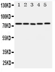 Anti-ABCG1 antibody, PA1868, Western blotting
All lanes: Anti ABCG1 (PA1868) at 0.5ug/ml

Lane 1: U87 Whole Cell Lysate at 40ug

Lane 2: SMMC Whole Cell Lysate at 40ug

Lane 3: HELA Whole Cell Lysate at 40ug

Lane 4: COLO320 Whole Cell Lysate at 40ug

Lane 5: MCF-7 Whole Cell Lysate at 40ug

Predicted bind size: 75KD

Observed bind size: 75KD