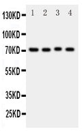 Anti-BCRP/ABCG2 antibody, PA1870, Western blotting
All lanes: Anti BCRP/ABCG2 (PA1870) at 0.5ug/ml

Lane 1: Rat Liver Tissue Lysate at 50ug

Lane 2: Rat Spleen Tissue Lysate at 50ug

Lane 3: Rat Kidney Tissue Lysate at 50ug

Lane 4: Mouse Spleen Tissue Lysate at 50ug

Predicted bind size: 72KD

Observed bind size: 72KD
