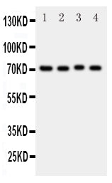 Anti-BCRP/ABCG2 antibody, PA1870, Western blotting
All lanes: Anti BCRP/ABCG2 (PA1870) at 0.5ug/ml

Lane 1: Rat Liver Tissue Lysate at 50ug

Lane 2: Rat Spleen Tissue Lysate at 50ug

Lane 3: Rat Kidney Tissue Lysate at 50ug

Lane 4: Mouse Spleen Tissue Lysate at 50ug

Predicted bind size: 72KD

Observed bind size: 72KD