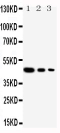 Anti-Cullin 2 antibody, PA1877, Western blotting
Recombinant Protein Detection Source: E.coli derived -recombinant human Cul2, 46.5KD
(162aa tag+L150-Y394)
Lane 1: Recombinant Human Cul2 Protein 10ng

Lane 2: Recombinant Human Cul2 Protein 5ng

Lane 3: Recombinant Human Cul2 Protein 2.5ng