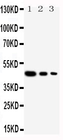 Anti-Cullin 2 antibody, PA1877, Western blotting
Recombinant Protein Detection Source: E.coli derived -recombinant human Cul2, 46.5KD
(162aa tag+L150-Y394)
Lane 1: Recombinant Human Cul2 Protein 10ng

Lane 2: Recombinant Human Cul2 Protein 5ng

Lane 3: Recombinant Human Cul2 Protein 2.5ng