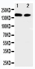 Anti-ErbB 4 antibody, PA1881, Western blotting
Lane 1: A549 Cell Lysate
Lane 2: HELA Cell Lysate