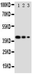 Anti-GATA2 antibody, PA1884, Western blotting
Recombinant Protein Detection Source: E.coli derived -recombinant Human GATA2, 38.3KD
(162aa tag+ M1-G200)
Lane 1: Recombinant Human GATA2 Protein 10ng

Lane 2: Recombinant Human GATA2 Protein 5ng

Lane 3: Recombinant Human GATA2 Protein 2.5ng