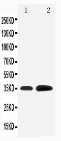 Anti-KLF3 antibody, PA1888, Western blotting
Lane 1: Rat Testis Tissue Lysate
Lane 2: HELA Cell Lysate