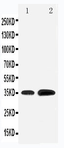 Anti-KLF3 antibody, PA1888, Western blotting
Lane 1: Rat Testis Tissue Lysate
Lane 2: HELA Cell Lysate