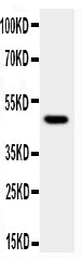 Anti-JNK1 antibody, PA1892, Western blotting
WB: HT1080 Cell Lysate