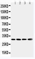 Anti-Superoxide Dismutase 3/SOD3 Antibody Picoband®
