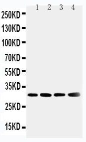 Anti-Superoxide Dismutase 3/SOD3 Antibody Picoband®