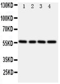Anti-TXNRD2 Antibody Picoband®