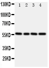 Anti-TXNRD2 Antibody Picoband®