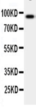 Anti-GCSF Receptor antibody, PA1906, Western blotting
WB: Human Placenta Tissue Lysate