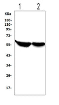 Anti-Cytochrome P450 2E1/CYP2E1 Antibody Picoband®