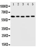 Anti-Iduronate 2 sulfatase antibody, PA1917, Western blotting
Lane 1: HELA Cell Lysate
Lane 2: SMMC Cell Lysate
Lane 3: A549 Cell Lysate
Lane 4: MCF-7 Cell Lysate
Lane 5: COLO Cell Lysate