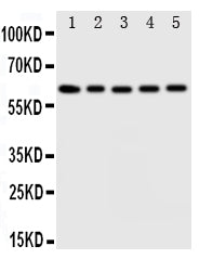 Anti-Iduronate 2 sulfatase antibody, PA1917, Western blotting
Lane 1: HELA Cell Lysate
Lane 2: SMMC Cell Lysate
Lane 3: A549 Cell Lysate
Lane 4: MCF-7 Cell Lysate
Lane 5: COLO Cell Lysate