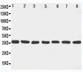 Anti-MEK6 antibody, PA1921, Western blotting
Lane 1: Rat Ovary Tissue Lysate
Lane 2: Rat Spleen Tissue Lysate
Lane 3: Rat Brain Tissue Lysate
Lane 4: Rat Heart Tissue Lysate
Lane 5: NIH3I3 Cell Lysate
Lane 6: HELA Cell Lysate
Lane 7: JRUKAT Cell Lysate

Lane 8: MCF-7 Cell Lysate