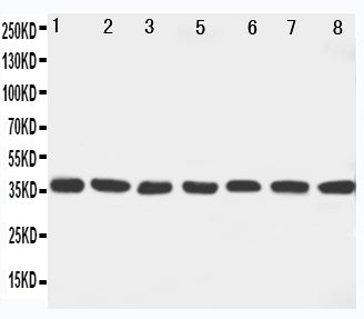 Anti-MEK6 antibody, PA1921, Western blotting
Lane 1: Rat Ovary Tissue Lysate
Lane 2: Rat Spleen Tissue Lysate
Lane 3: Rat Brain Tissue Lysate
Lane 4: Rat Heart Tissue Lysate
Lane 5: NIH3I3 Cell Lysate
Lane 6: HELA Cell Lysate
Lane 7: JRUKAT Cell Lysate

Lane 8: MCF-7 Cell Lysate