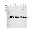 Anti-Nucleophosmin/NPM1 Antibody Picoband®