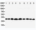 Anti-Prohibitin/PHB Antibody Picoband®