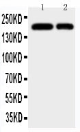Anti-CD11b antibody, PA1943-1, All Western blotting
All lanes: Anti-ITGAM(PA1943-1) at 0.5ug/ml

Lane 1: JURKAT Whole Cell Lysate at 40ug

Lane 2: RAJI Whole Cell Lysate at 40ug

Predicted bind size: 127KD

Observed bind size: 170KD
