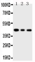 Anti-SAPK4 antibody, PA1944, Western blotting
Lane 1: PANC Cell Lysate
Lane 2: COLO320 Cell Lysate
Lane 3: JURKAT Cell Lysate