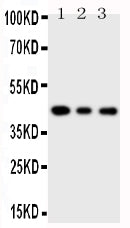 Anti-SAPK4 antibody, PA1944, Western blotting
Lane 1: PANC Cell Lysate
Lane 2: COLO320 Cell Lysate
Lane 3: JURKAT Cell Lysate