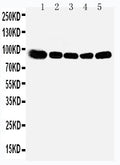 Anti-OSBP1 antibody, PA1949, Western blotting
Lane 1: Rat Kidney Tissue Lysate
Lane 2: Rat Spleen Tissue Lysate
Lane 3: Rat Lung Tissue Lysate
Lane 4: HELA Cell Lysate
Lane 5: A549 Cell Lysate